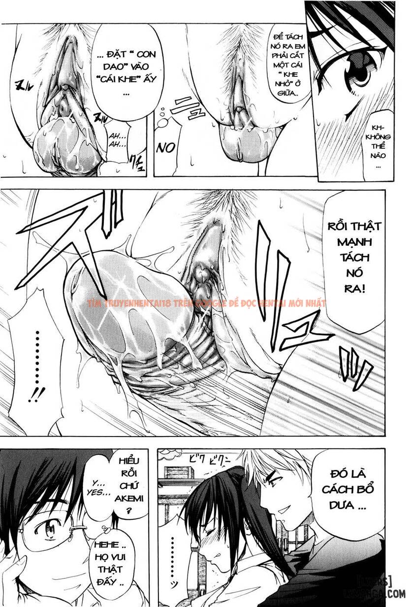 Xem ảnh 10 trong truyện hentai Anal Backer - Chapter 3 - hentaitvn.net