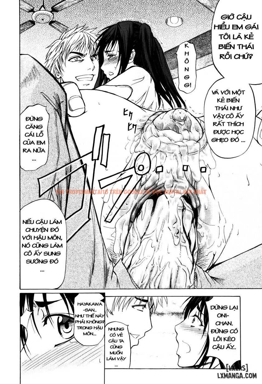 Xem ảnh 23 trong truyện hentai Anal Backer - Chapter 3 - hentaitvn.net